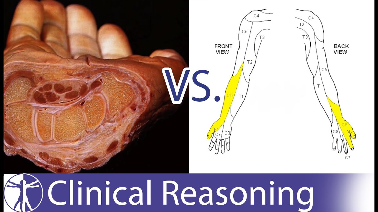 entrapment neuropathy of peripheral nerve of left hand icd 10